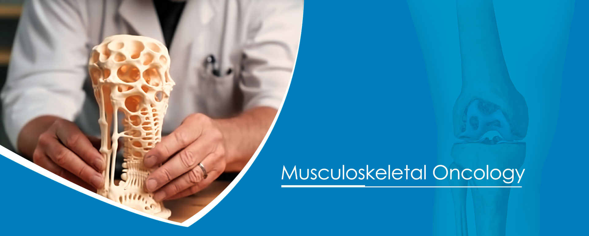 Musculoskeletal Oncology